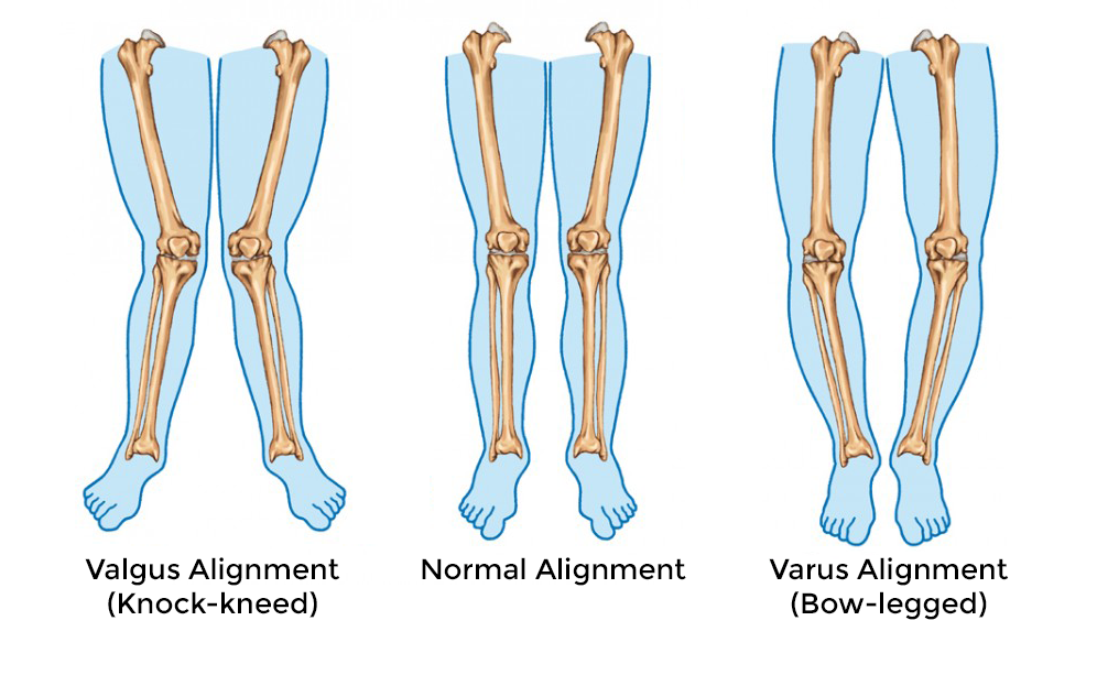 Human Leg Bent