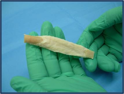 Z-lig animal tissue scaffold device ACL