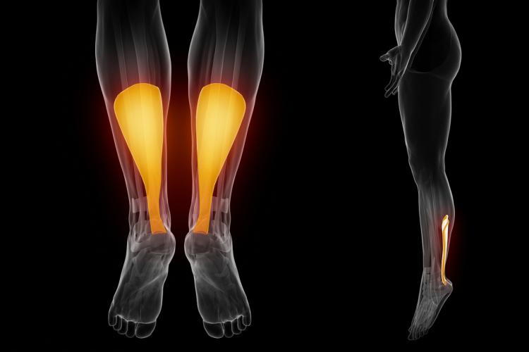 Achilles Tendon Injuries | Campbell Clinic