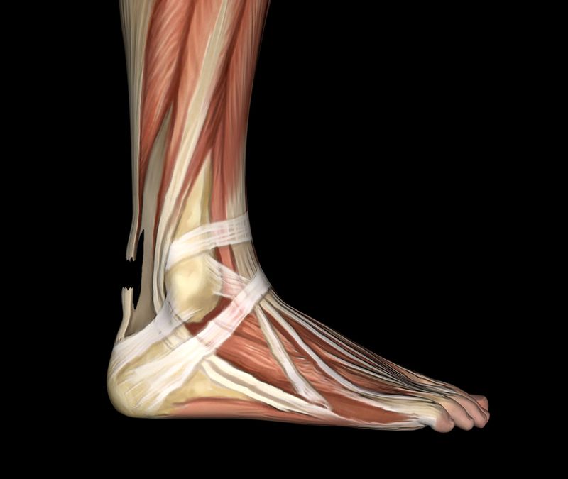 Top Facts About Achilles Tendon Pain, Tendonitis, and Achilles Rupture