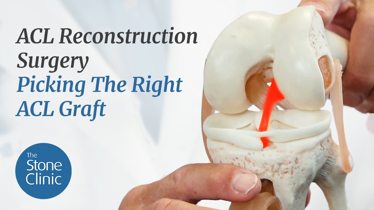 Picking the Right Graft for ACL Reconstruction 