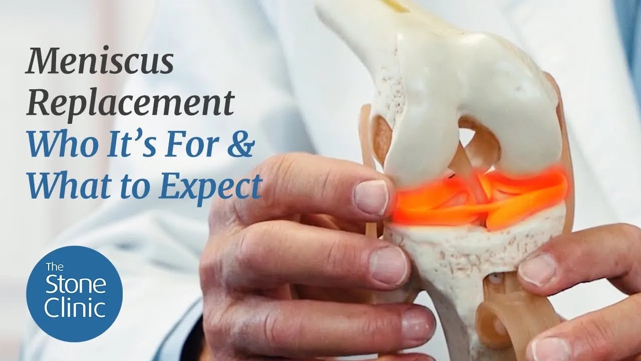 Who Is a Candidate for Meniscus Transplantation 