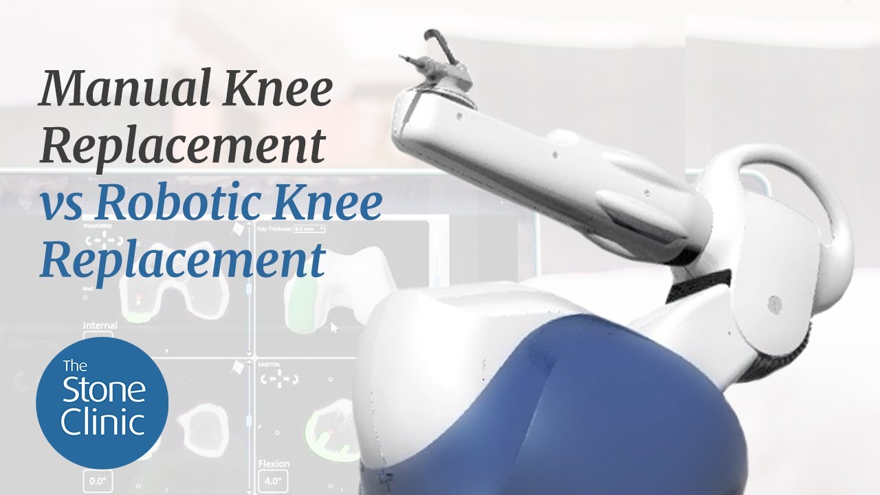 Robotic vs Manual Knee Replacement Explained 