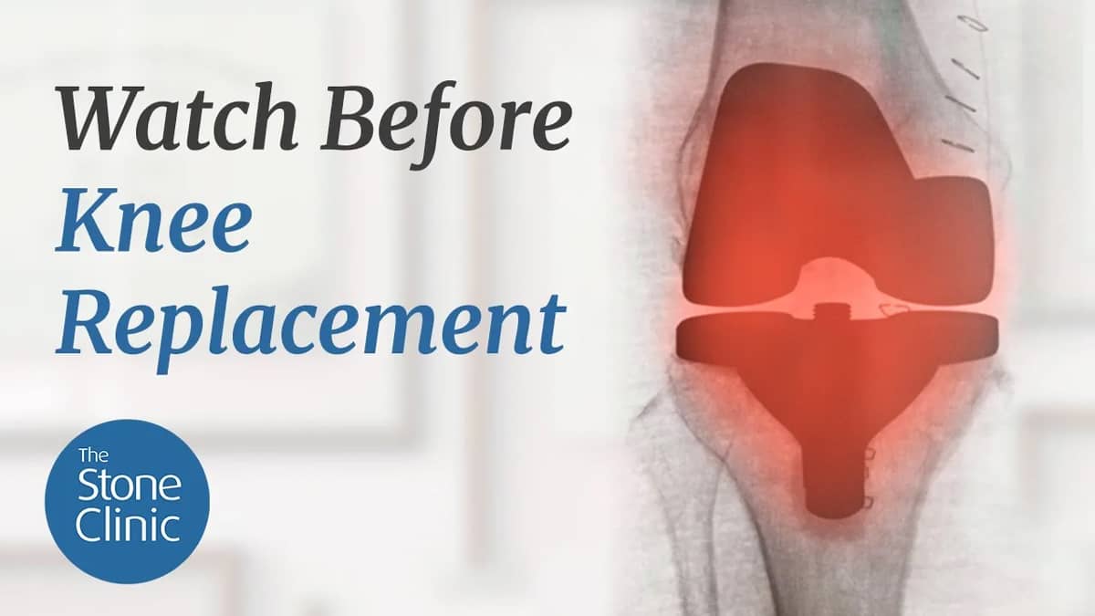 Do I Need a Knee Replacement 