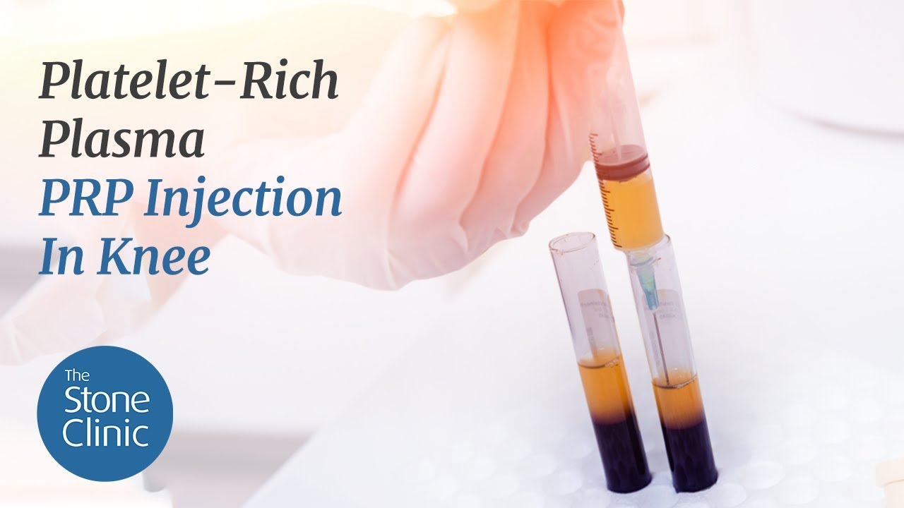 Platelet-Rich Plasma - PRP Injection In Knee for Knee Pain & Arthritis