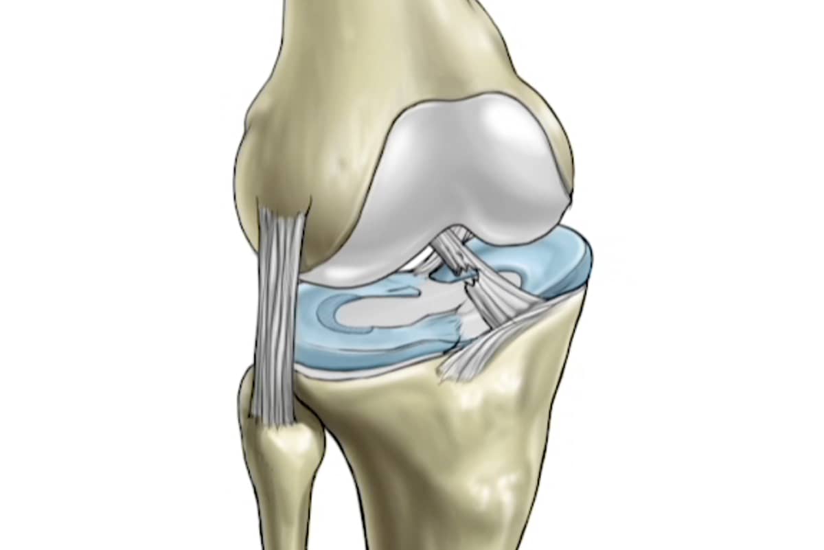 ACL Study Group 2023 Meeting Recap