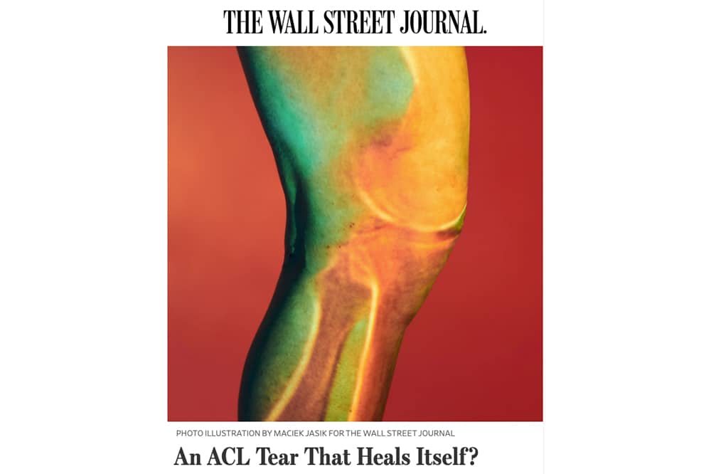 An ACL Tear That Heals Itself? WSJ Kevin Stone, MD