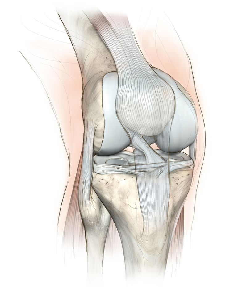 Failed Articular Cartilage Repair Techniques