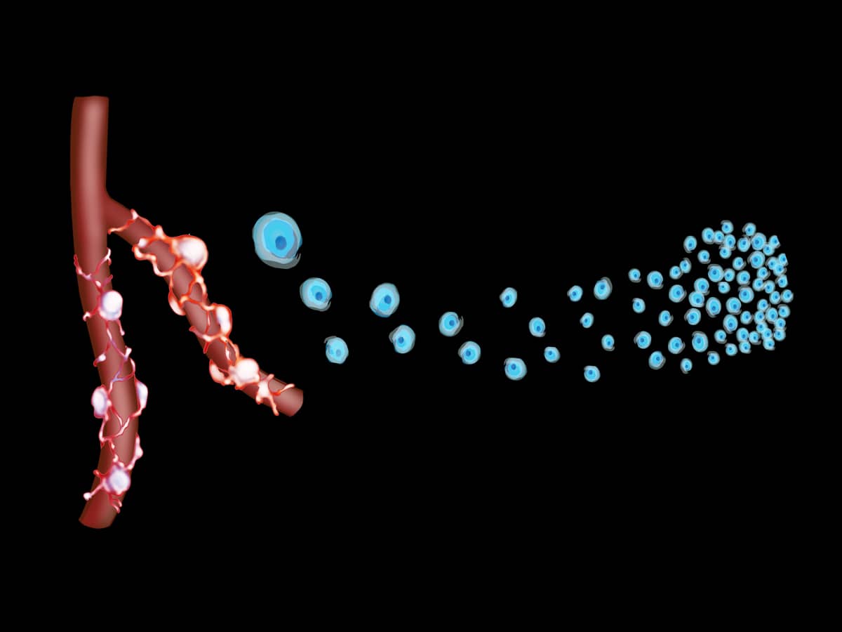Stem Cell MSCs Progenitor Cells in Orthopaedics
