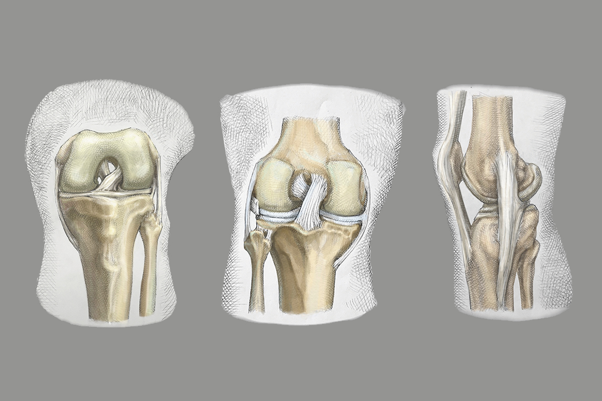 Knee Ligaments 3 Views