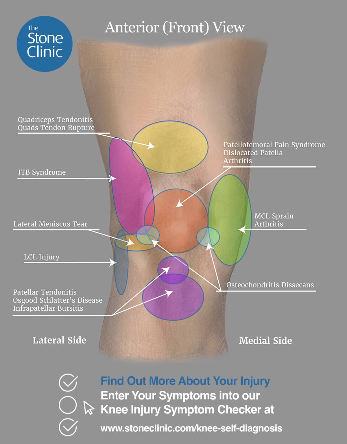 Anatomy of the Knee joint Quiz