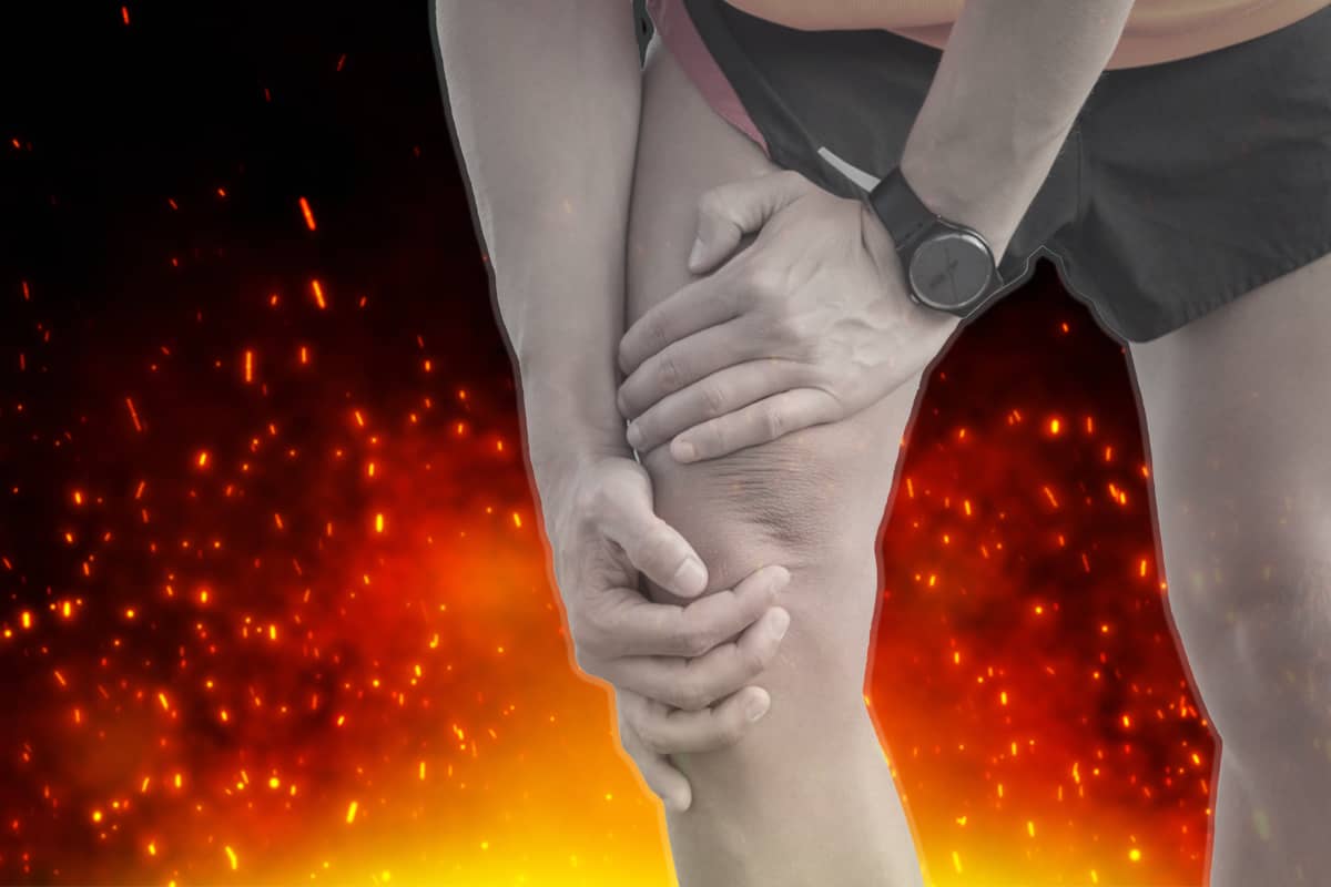 Arthritic Knee From Missing Meniscus