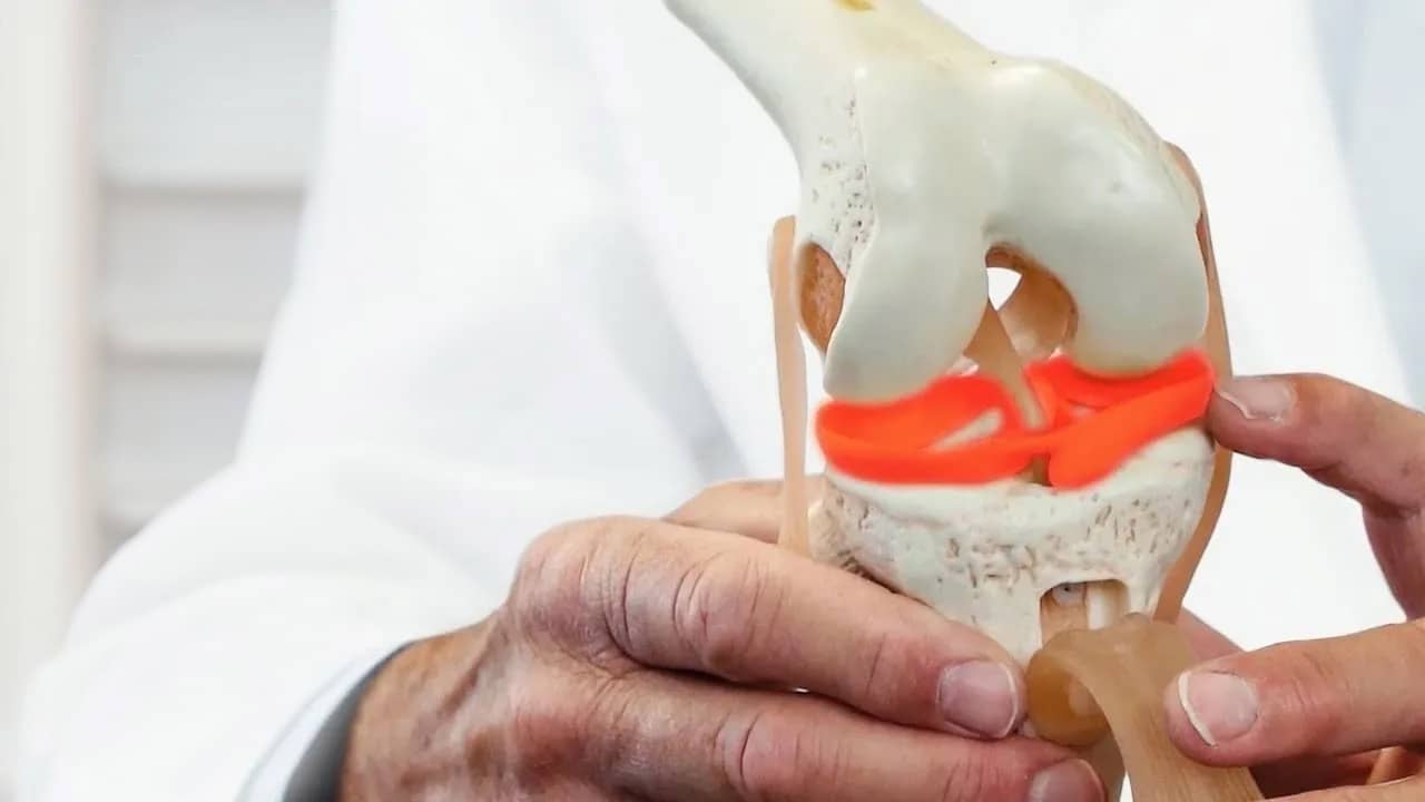 Knee Meniscus Model 