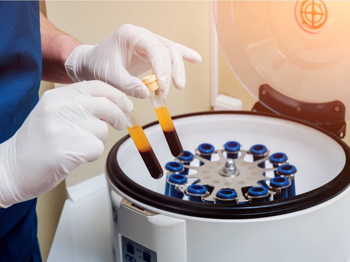 PRP Injections for Knee, Shoulder, Ankle, Spine