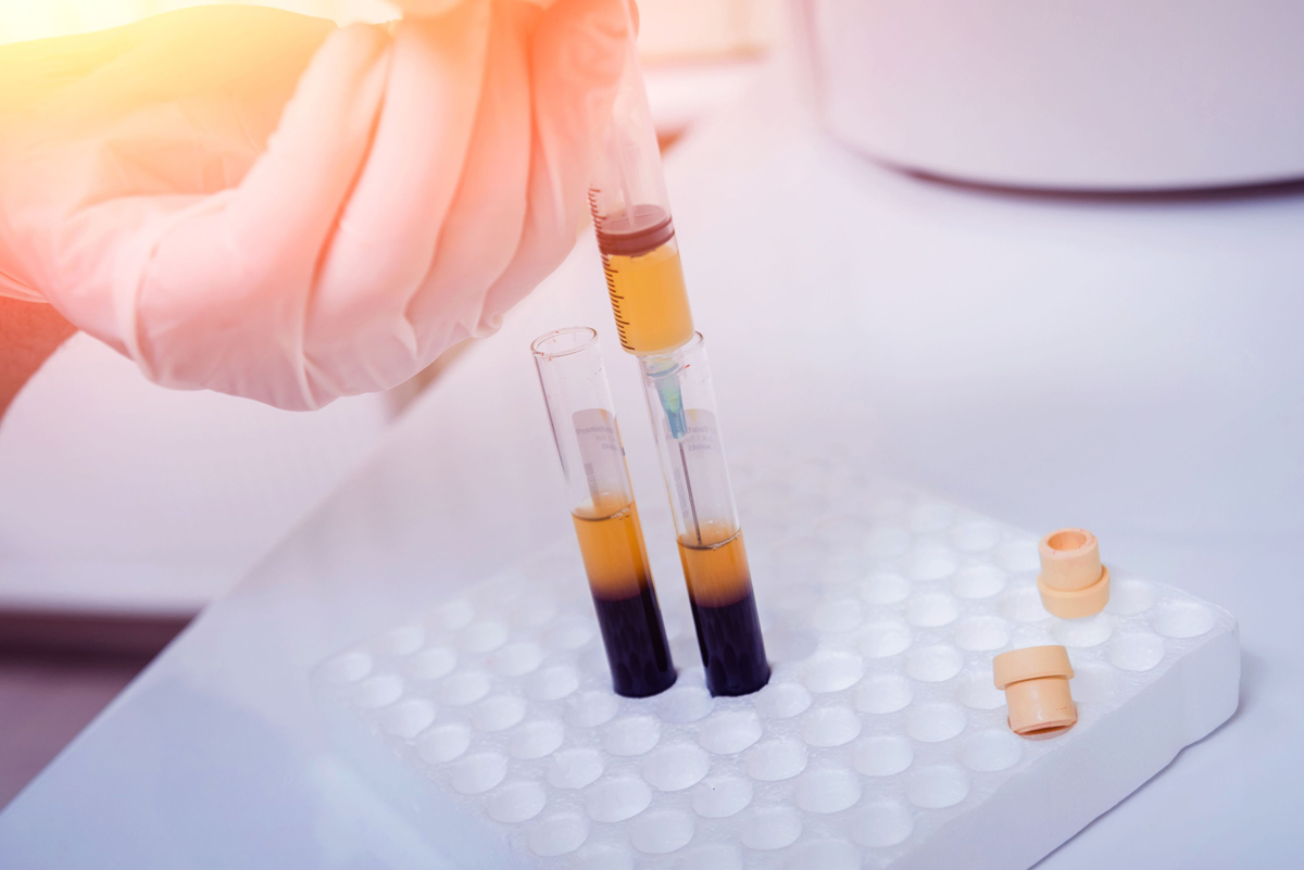 PRP Injection Elixir