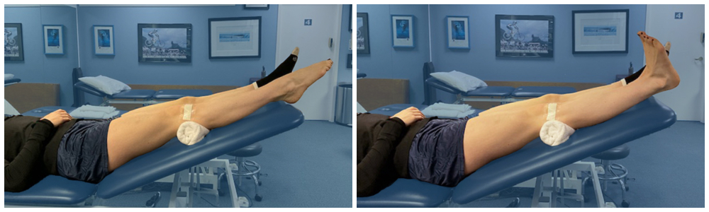 Post Knee Surgery Exercise_ Ankle Pumps