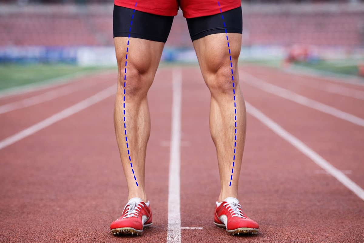 Bowlegged Runner | Joint Alignment & Running Mechanics