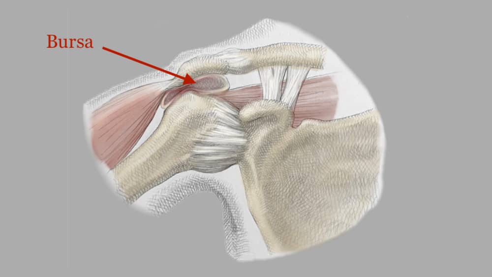 Shoulder Bursitis Diagram