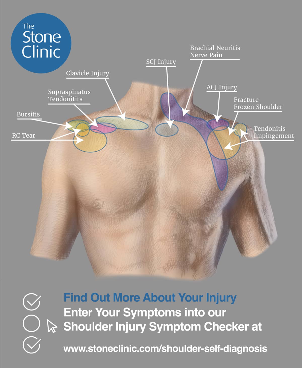 Shoulder Pain Symptom Checker & Pain Diagnosis Chart [Injury Self