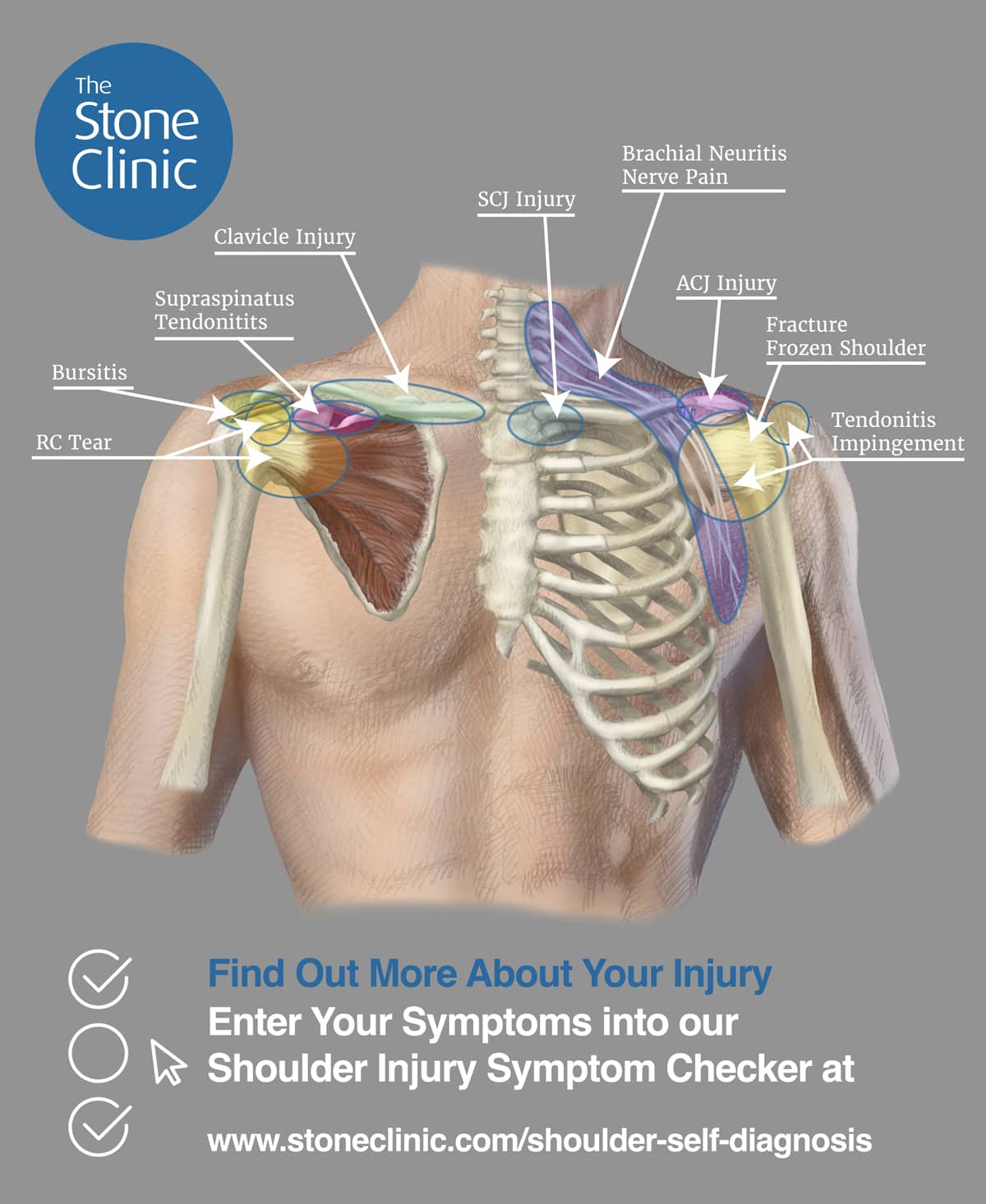 Shoulder Pain: Causes, Symptoms & Relief