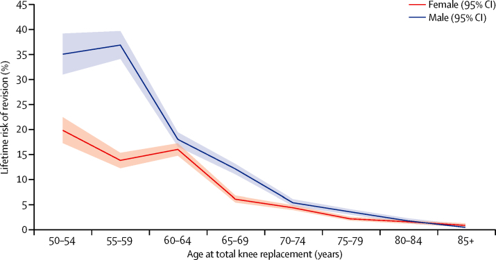 Lifetime risk of revision after total knee replacement Plot showing estimates of lifetime risk of total knee replacement revision against age at the time of primary total knee replacement surgery
