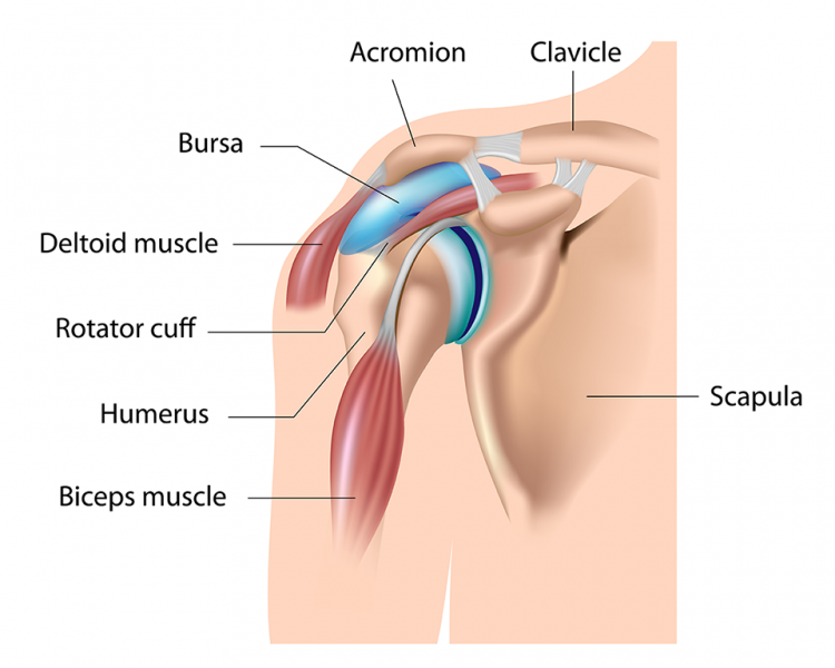 torn bursa sac in shoulder)