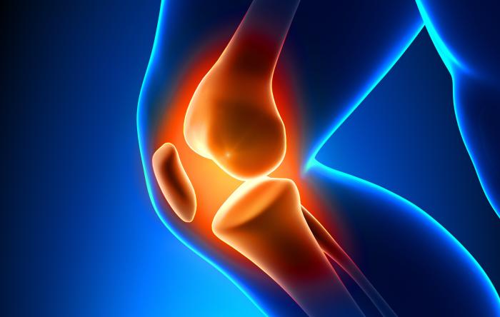 Arthritis may in fact be preventable if we are able to stop the production of the enzymes early after injury