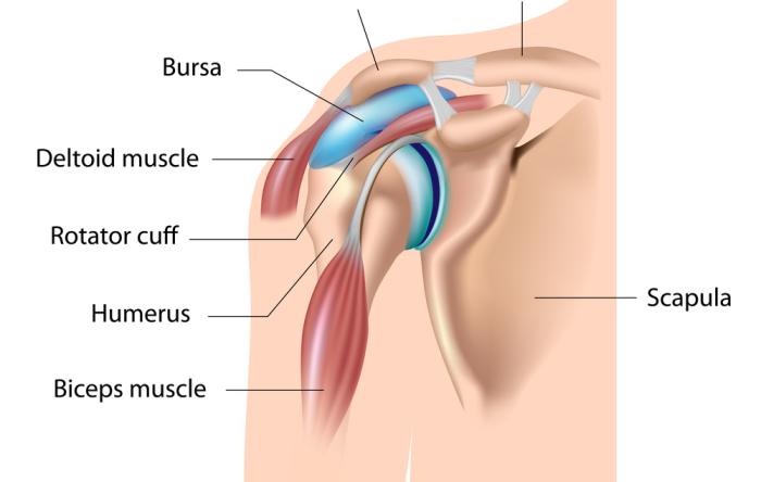 Shoulder Pain: It may be an easy fix