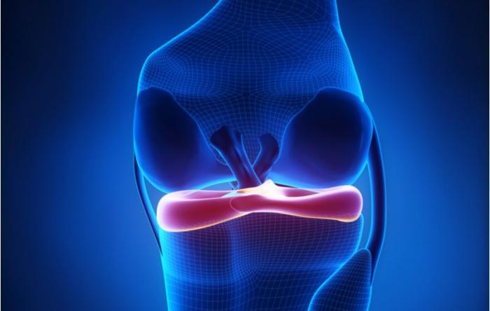 Meniscus Disease: Anatomy Graphic