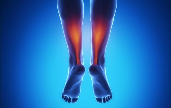 Why Avoid Open Achilles Repair 