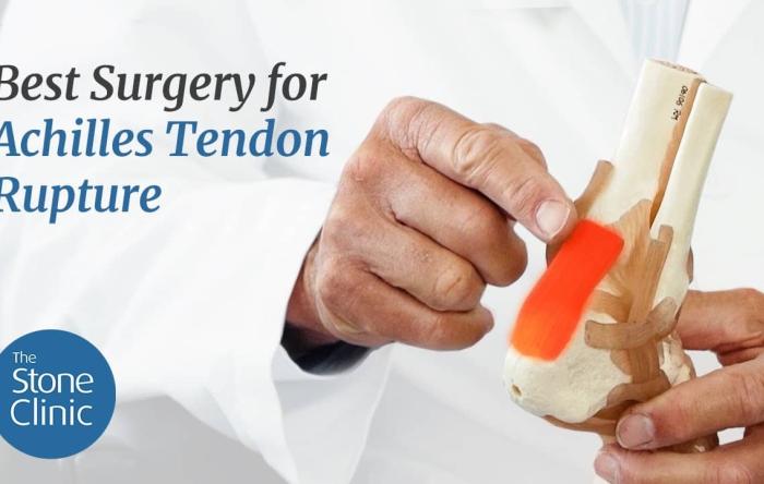 Best Surgery for Achilles Tendon Rupture