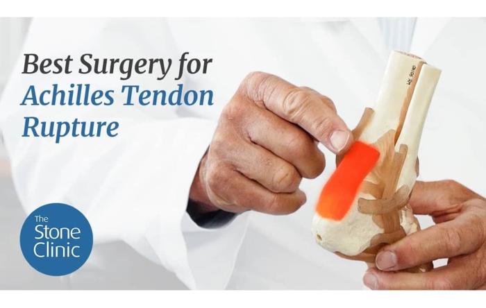 Best Surgery for Achilles Rupture