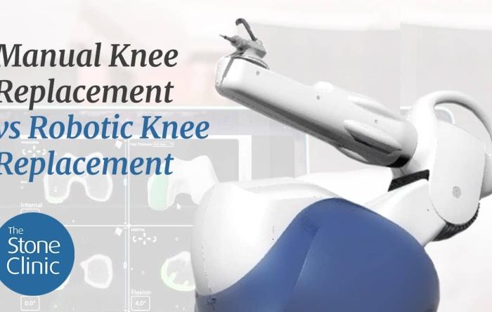 Manual vs Robotic Knee Replacement 