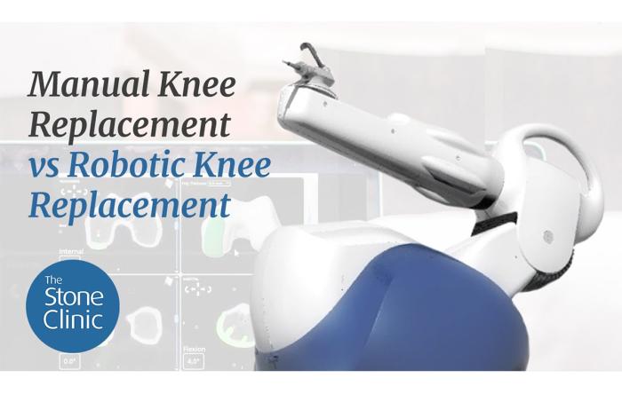 A) Mako robot for total knee arthroplasty. (B) Mako's computer