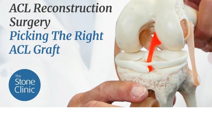 ACL Reconstruction Surgery Which Graft to Choose