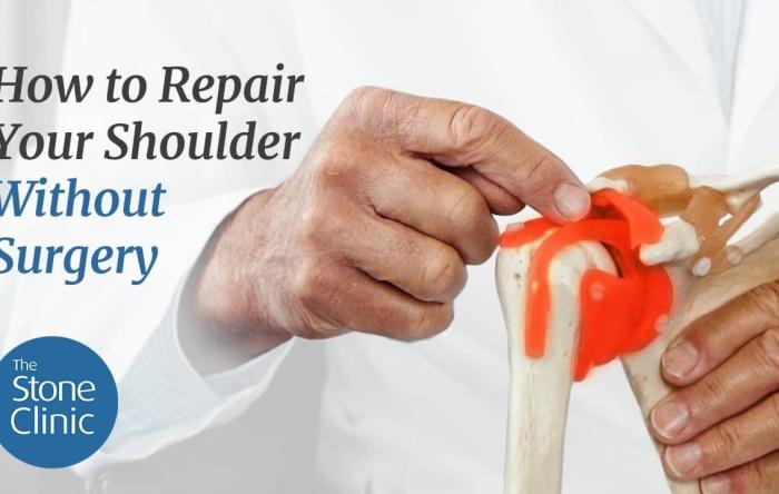 How to Repair a Shoulder Without Surgery