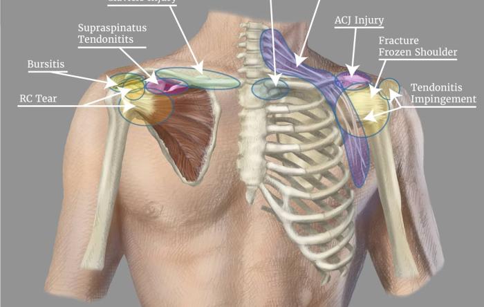 When To Have Shoulder Surgery Injury Chart