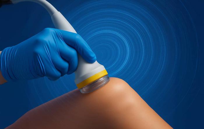 Shockwave Therapy in San Francisco, CA
