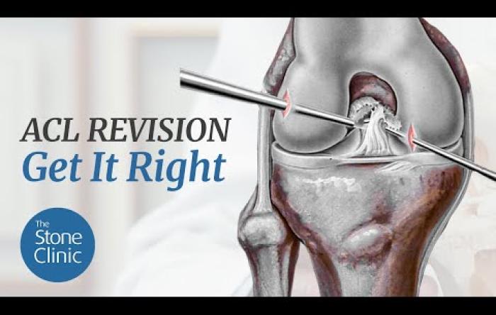 Embedded thumbnail for ACL Revision Surgery - The Keys To Getting it Right