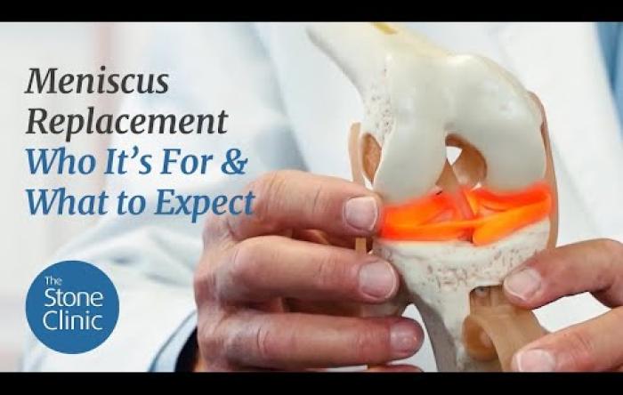Embedded thumbnail for Meniscus Transplant - Who&#039;s It For &amp; What To Expect