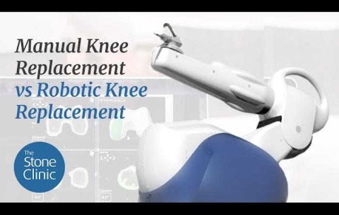 Embedded thumbnail for Manual vs Robotic Knee Replacement Explained 
