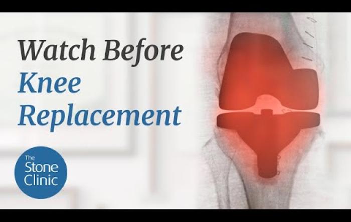 Embedded thumbnail for You Likely Don&#039;t Need A Knee Replacement (80% Don&#039;t)